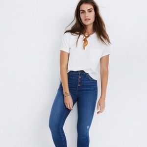 Madewell 10" button fly high rise skinny jeans